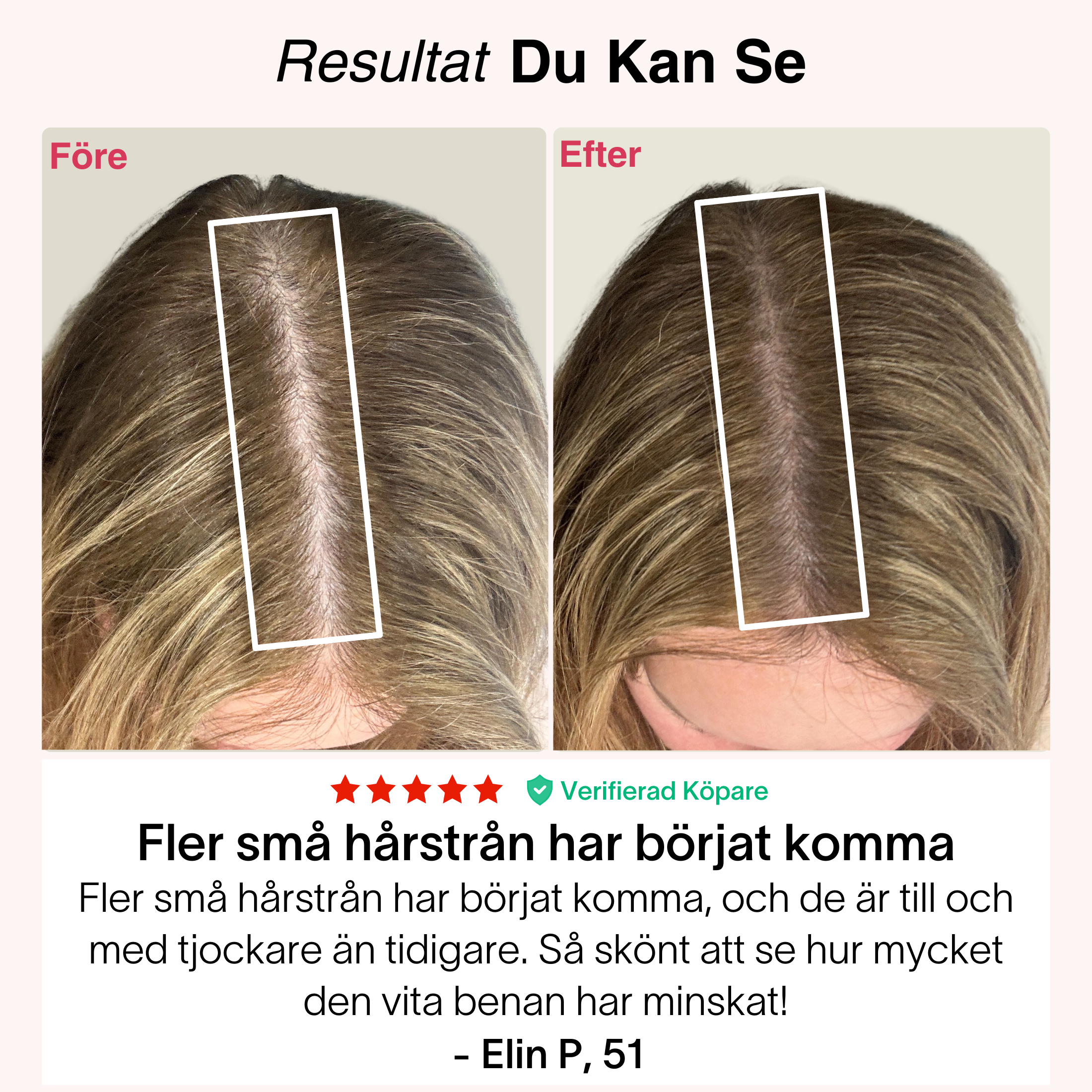 Rödljus-Kepsen®
