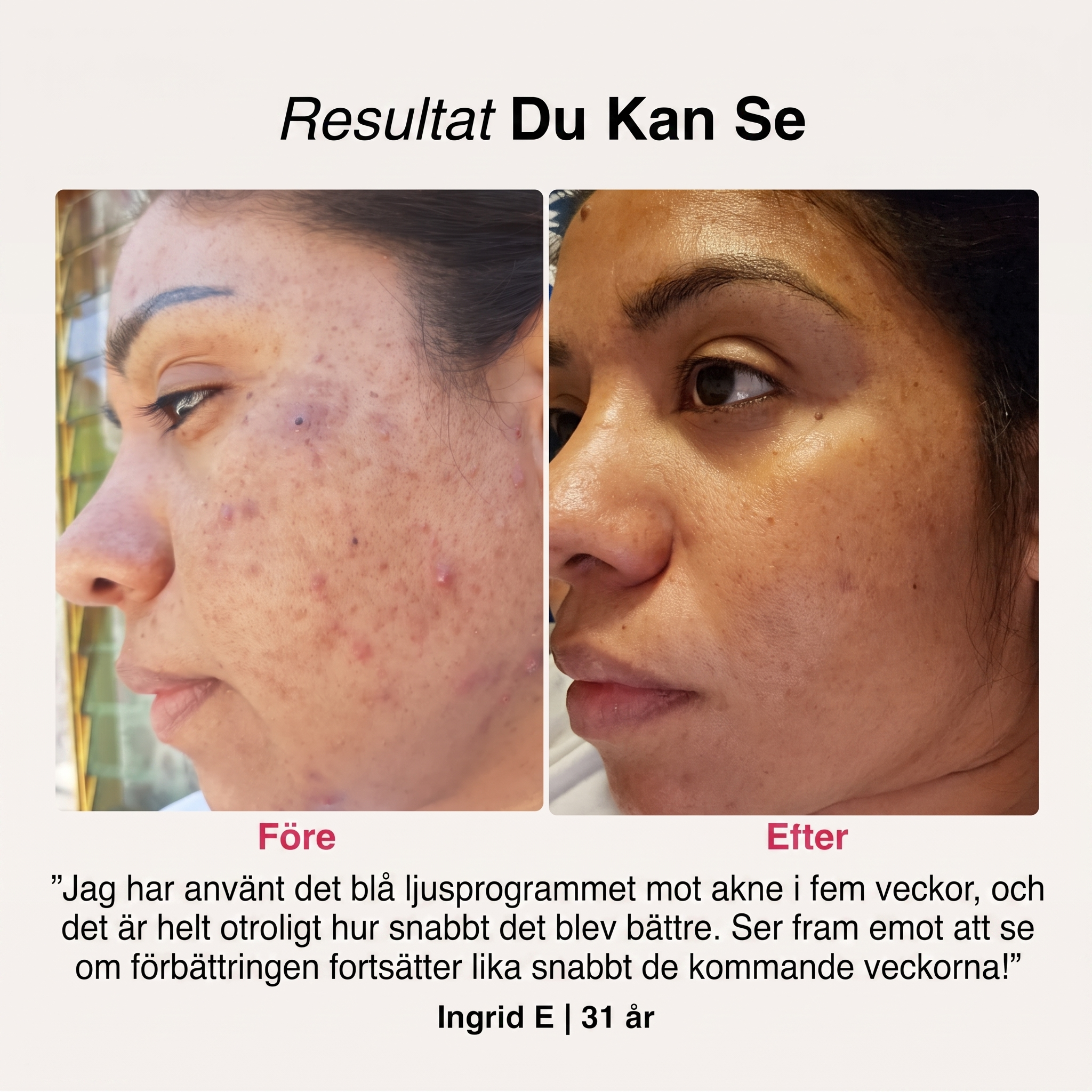 SoftSkin InfraLight® | Ansikte, Hals & Bröst